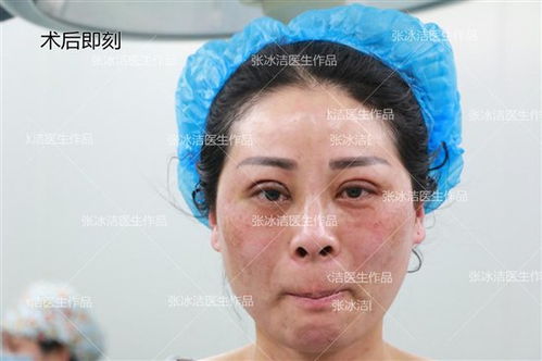 李荣浩与常州炎夏，热出双眼皮的奇妙故事